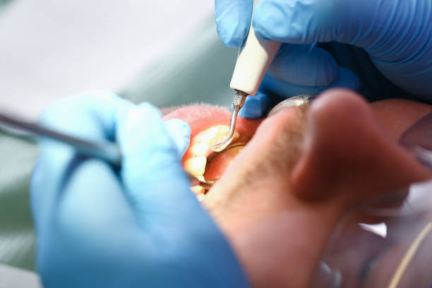 Best Dentist for Tooth Abscess  in Portsmouth, VA